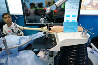 Associated research and development of orthopedic trauma treatment robot project